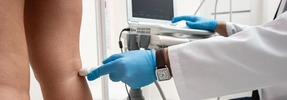 Первичный прием флеболога + УЗИ вен ног 1890 рублей (вместо 3900 рублей)