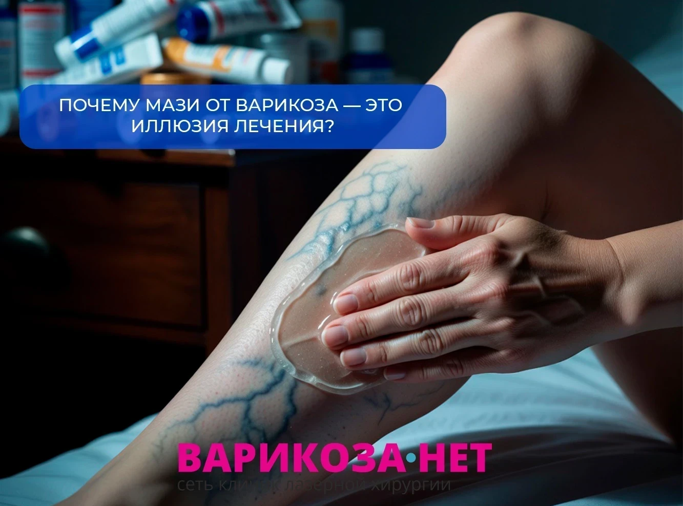 Почему мази от варикоза — это иллюзия лечения?